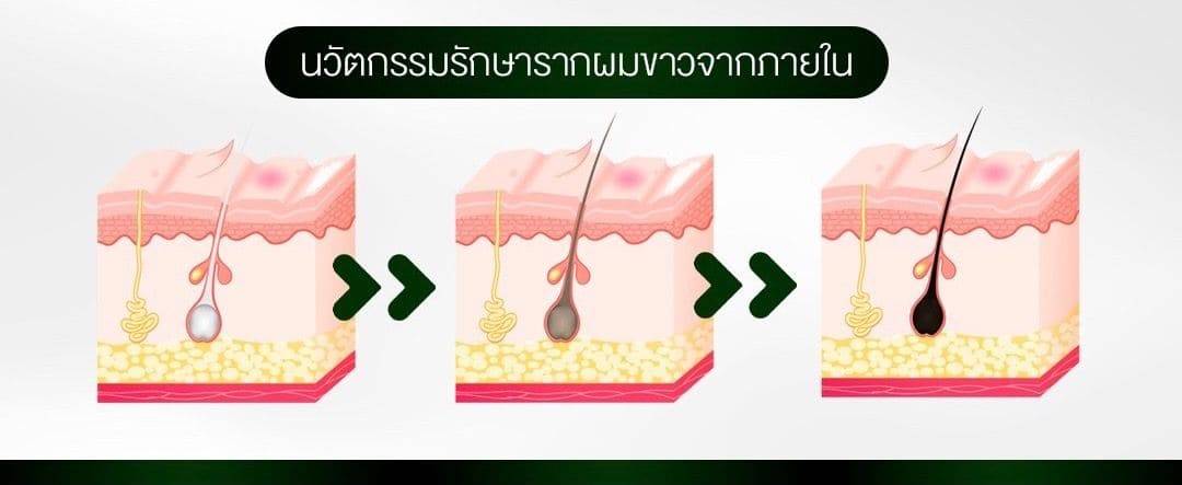 นวัตกรรมแก้หงอกที่ต้นตอ แก้หงอกตั้งแต่รากผมแบบไม่ใช่สารเคมีไม่ต้องย้อมผมให้แสบหัวอีกต่อไป